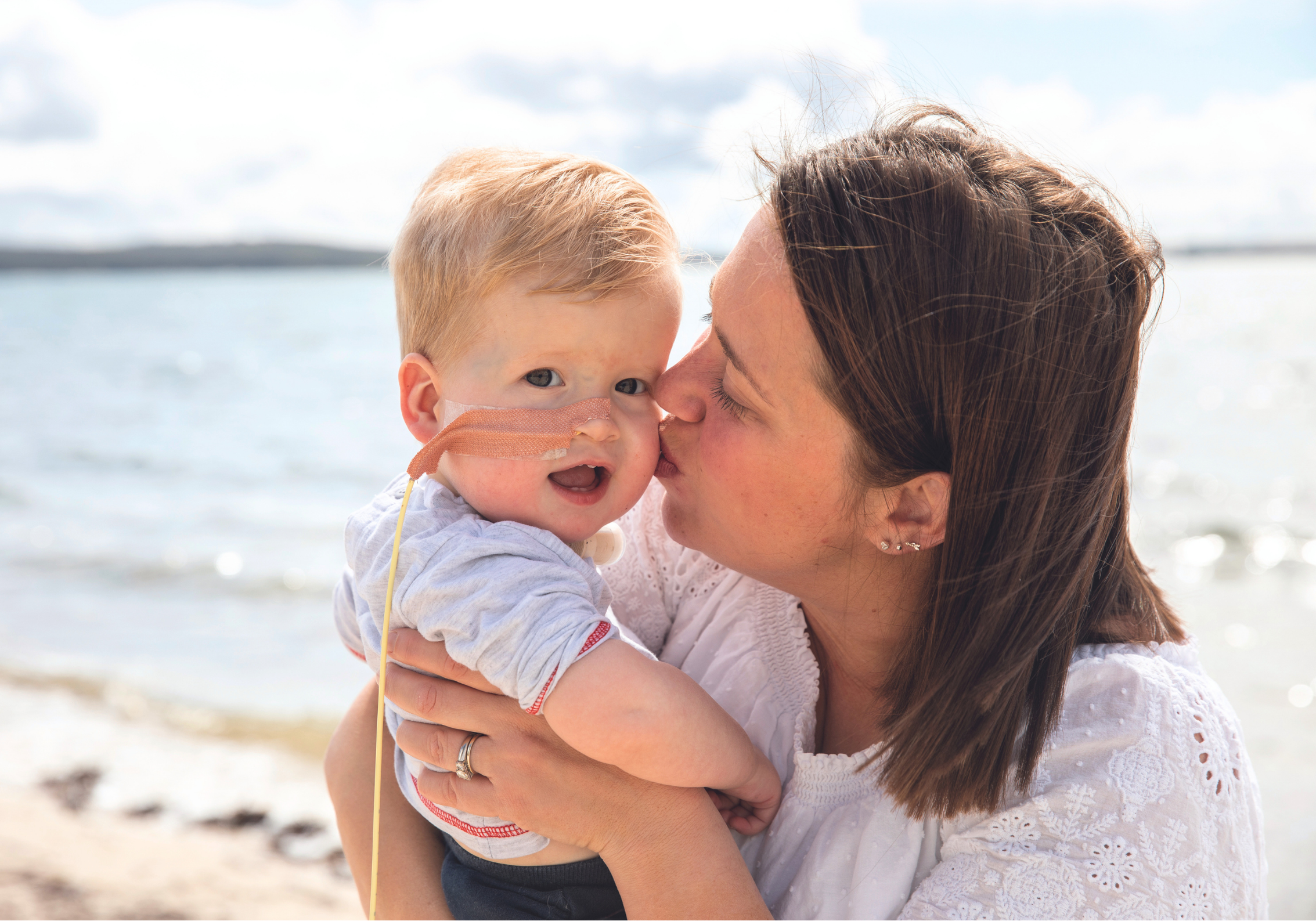 Young boy with feeding tube in his nose, being kissed on the cheek by mum on the beach